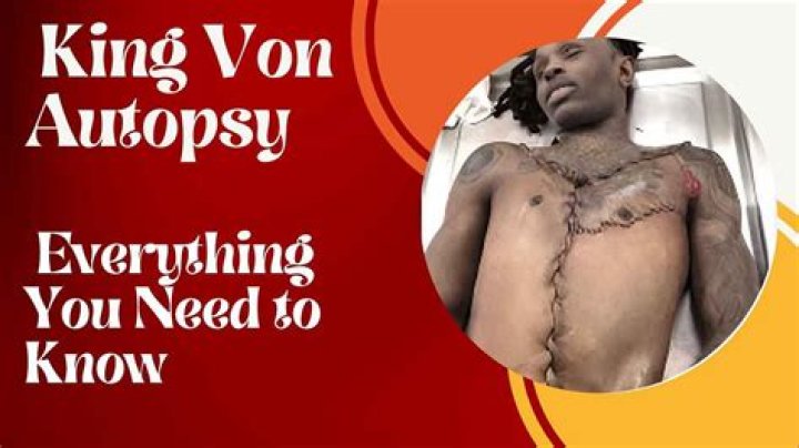 Revealing the Truth: A Deep Dive into King Von Autopsy Photos