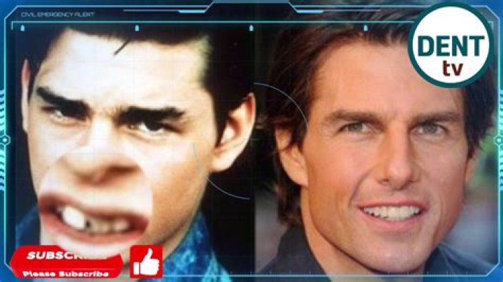 Tom Cruise's Midline Shift: A Detailed Analysis