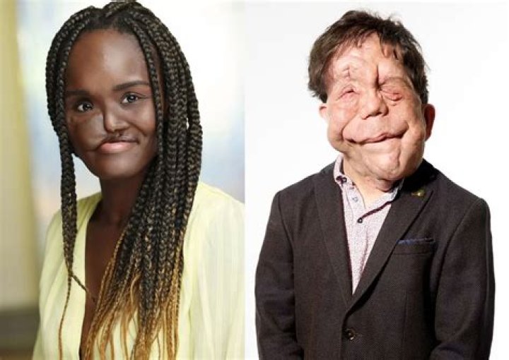 Unraveling the Mystery: Is Adam Pearson Married?