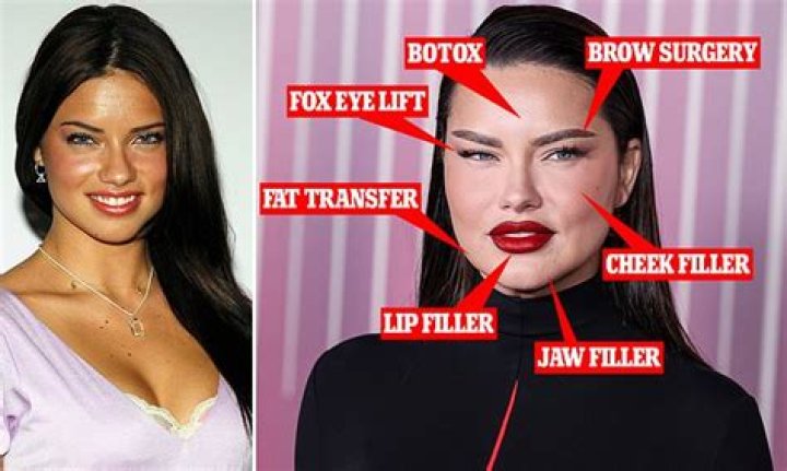 Unveiling the Truth Behind Adriana Lima's Fat: A Journey of Beauty and Body Image